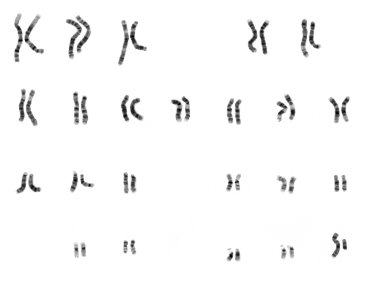 G-banded karyogram of a normal human male: 22 paired autosomes arranged largest to smallest in groups A through G, plus one X and one Y chromosome, each chromosome oriented with the short (p) arm up.